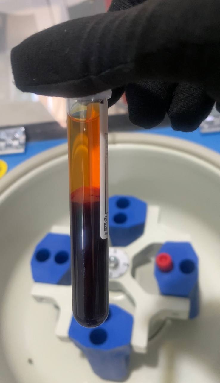 سن انجام تست HPV